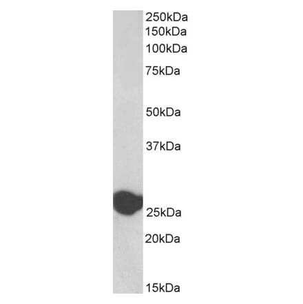 Western Blot - Anti-TPI1 Antibody (A83171) - Antibodies.com