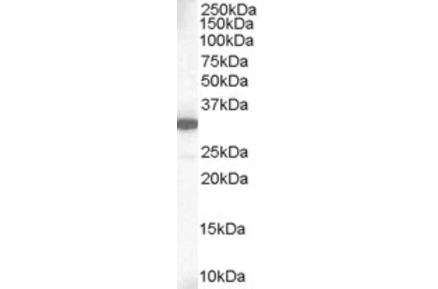 Western Blot - Anti-MCL1 Antibody (A83173) - Antibodies.com