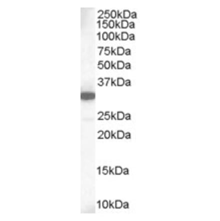 Western Blot - Anti-MCL1 Antibody (A83173) - Antibodies.com