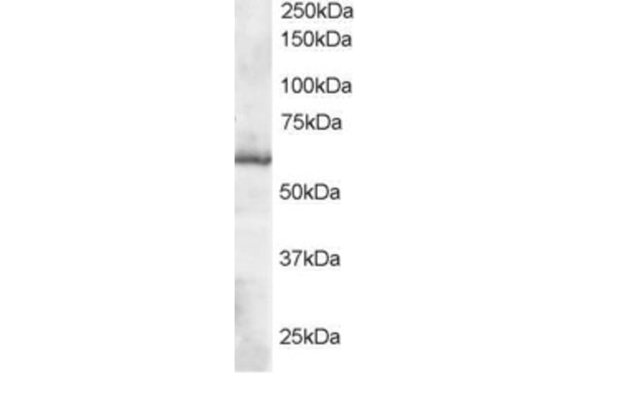 Western Blot - Anti-TXNRD1 Antibody (A83174) - Antibodies.com