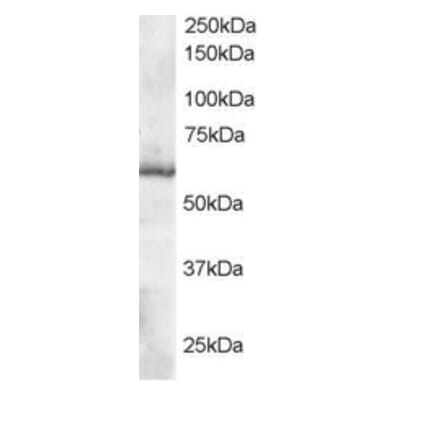 Western Blot - Anti-TXNRD1 Antibody (A83174) - Antibodies.com