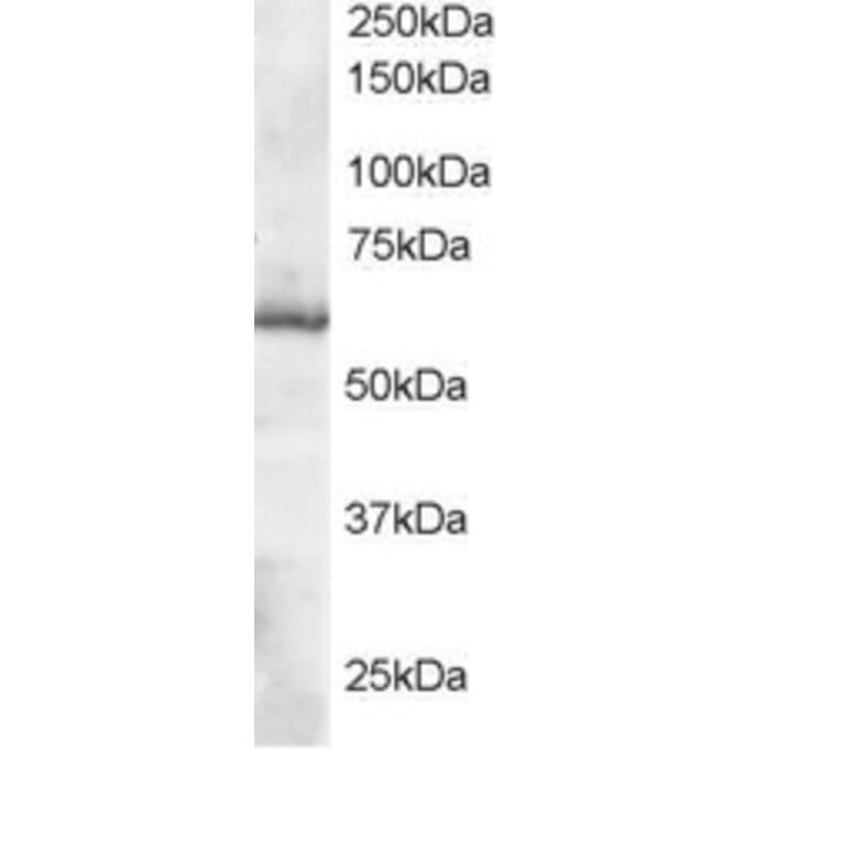 Western Blot - Anti-TXNRD1 Antibody (A83174) - Antibodies.com