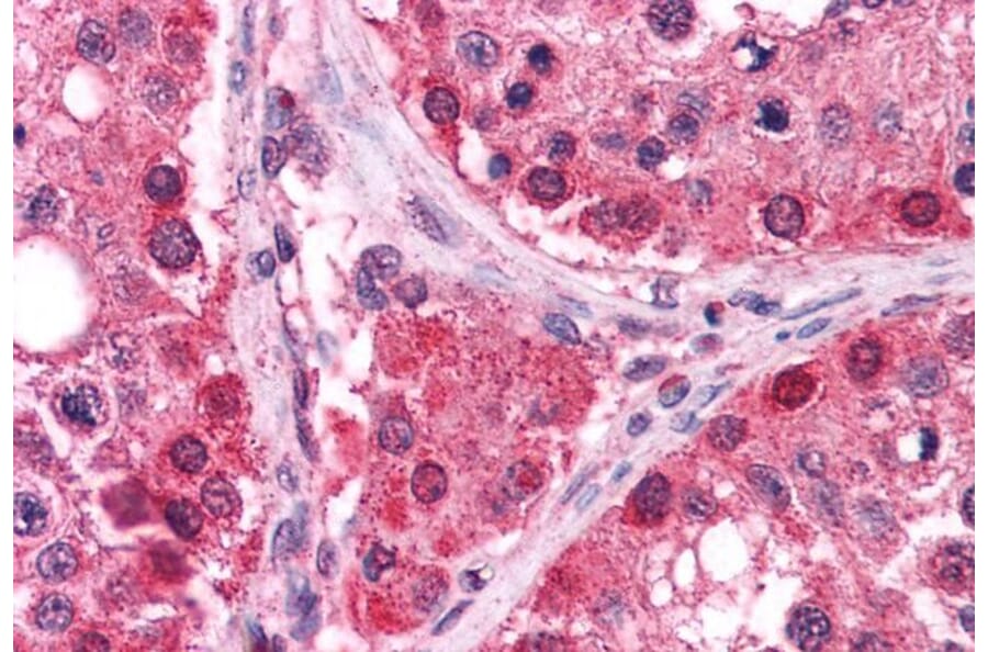 Immunohistochemistry - Anti-TXNRD1 Antibody (A83174) - Antibodies.com