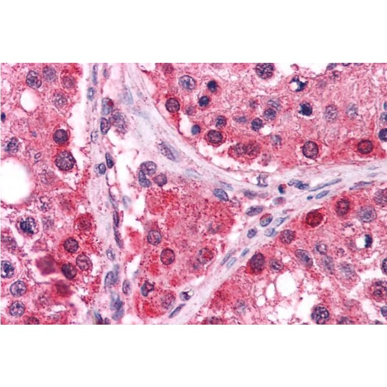 Immunohistochemistry - Anti-TXNRD1 Antibody (A83174) - Antibodies.com