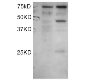 Western Blot - Anti-DYX1C1 Antibody (A83175) - Antibodies.com