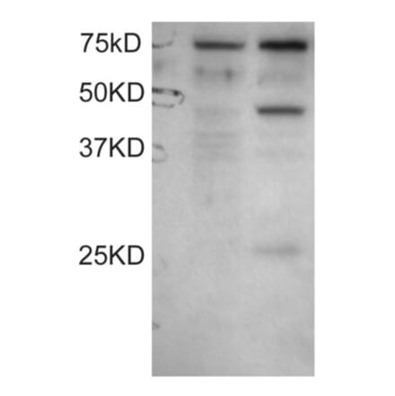 Western Blot - Anti-DYX1C1 Antibody (A83175) - Antibodies.com