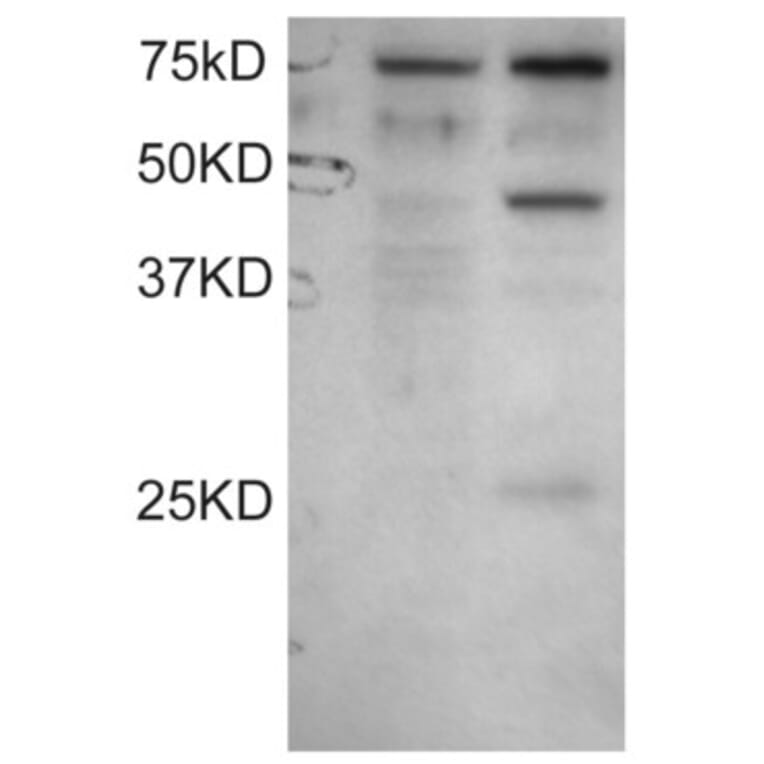 Western Blot - Anti-DYX1C1 Antibody (A83175) - Antibodies.com