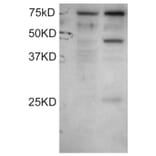 Western Blot - Anti-DYX1C1 Antibody (A83175) - Antibodies.com