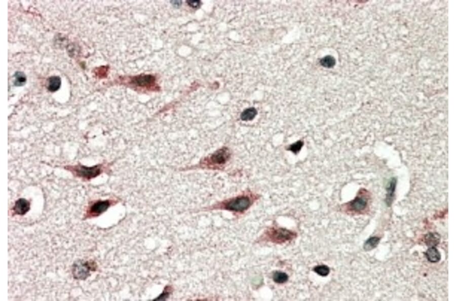 Immunohistochemistry - Anti-DYX1C1 Antibody (A83175) - Antibodies.com