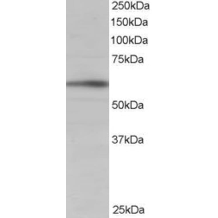 Western Blot - Anti-IRSp53 Antibody (A83176) - Antibodies.com