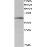 Western Blot - Anti-IRSp53 Antibody (A83176) - Antibodies.com