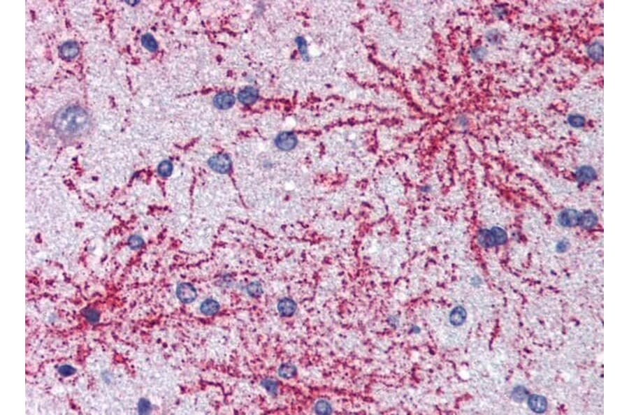 Immunohistochemistry - Anti-IRSp53 Antibody (A83176) - Antibodies.com