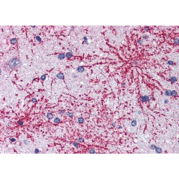 Immunohistochemistry - Anti-IRSp53 Antibody (A83176) - Antibodies.com