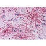 Immunohistochemistry - Anti-IRSp53 Antibody (A83176) - Antibodies.com