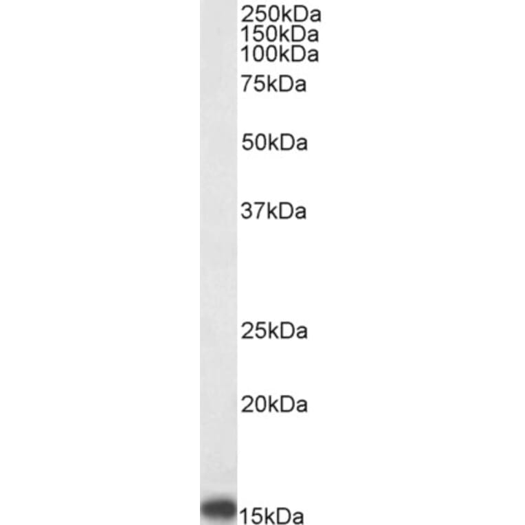 Western Blot - Anti-PBR Antibody (A83177) - Antibodies.com