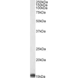 Western Blot - Anti-PBR Antibody (A83177) - Antibodies.com