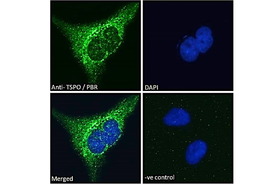 Immunofluorescence - Anti-PBR Antibody (A83177) - Antibodies.com