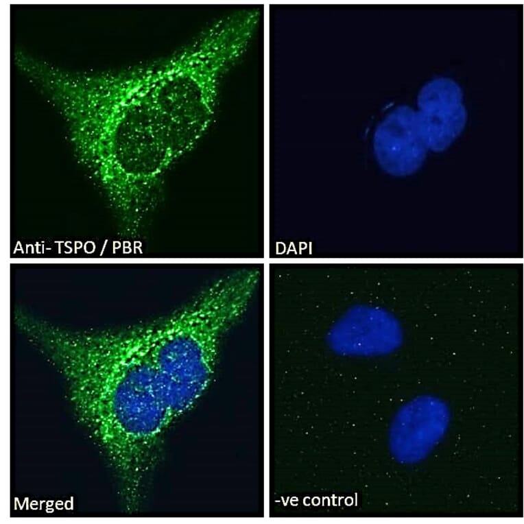 Immunofluorescence - Anti-PBR Antibody (A83177) - Antibodies.com
