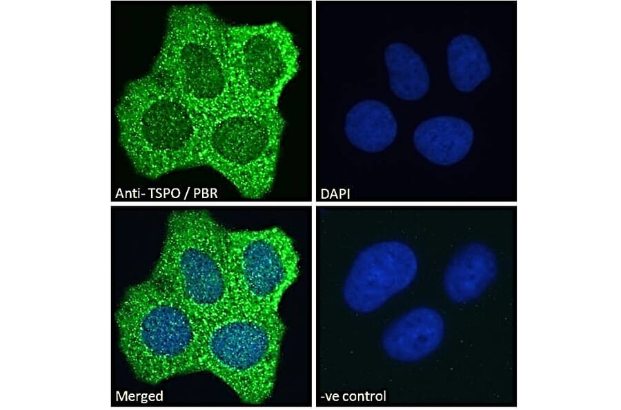 Immunofluorescence - Anti-PBR Antibody (A83177) - Antibodies.com