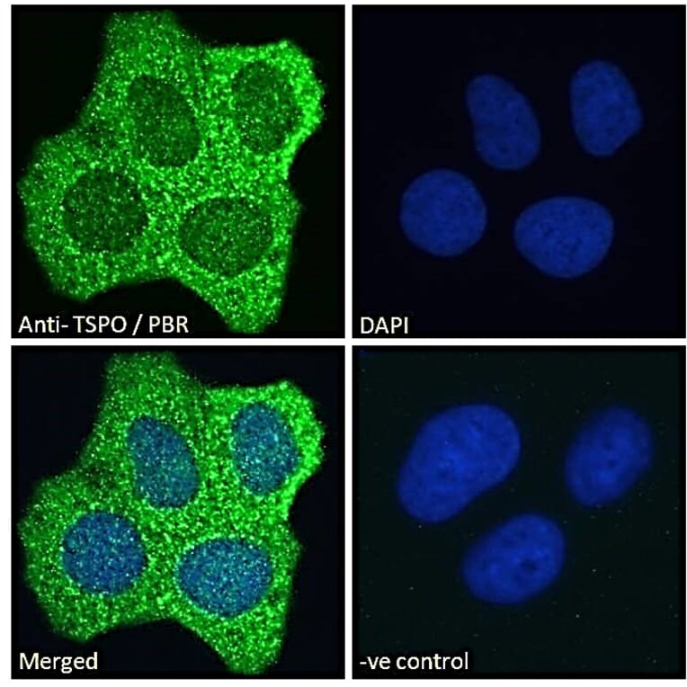 Immunofluorescence - Anti-PBR Antibody (A83177) - Antibodies.com