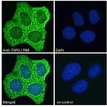 Immunofluorescence - Anti-PBR Antibody (A83177) - Antibodies.com
