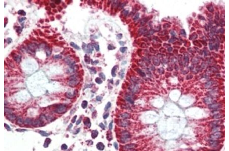 Immunohistochemistry - Anti-PBR Antibody (A83177) - Antibodies.com