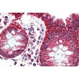 Immunohistochemistry - Anti-PBR Antibody (A83177) - Antibodies.com