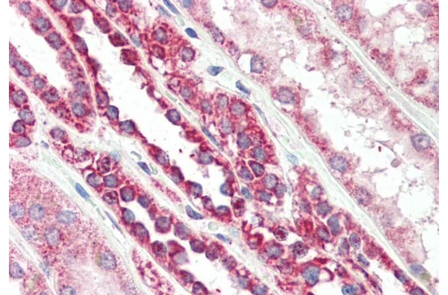 Immunohistochemistry - Anti-PBR Antibody (A83177) - Antibodies.com