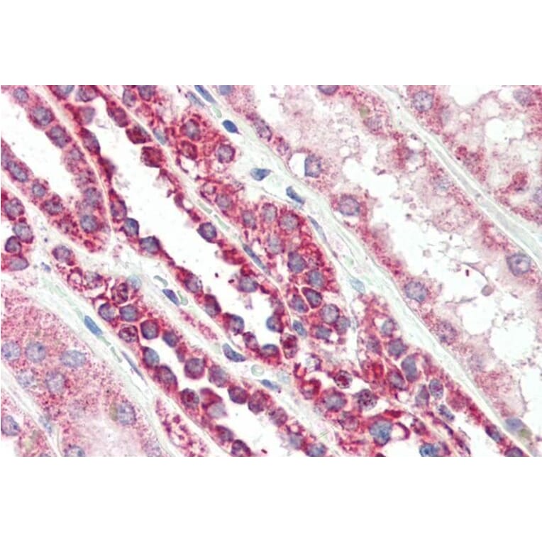 Immunohistochemistry - Anti-PBR Antibody (A83177) - Antibodies.com