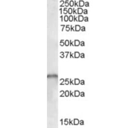 Western Blot - Anti-Gemin 1 Antibody (A83180) - Antibodies.com