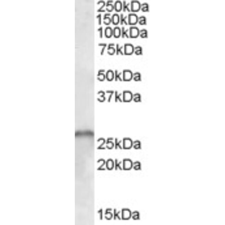 Western Blot - Anti-Gemin 1 Antibody (A83180) - Antibodies.com