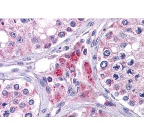 Immunohistochemistry - Anti-EYA4 Antibody (A83181) - Antibodies.com