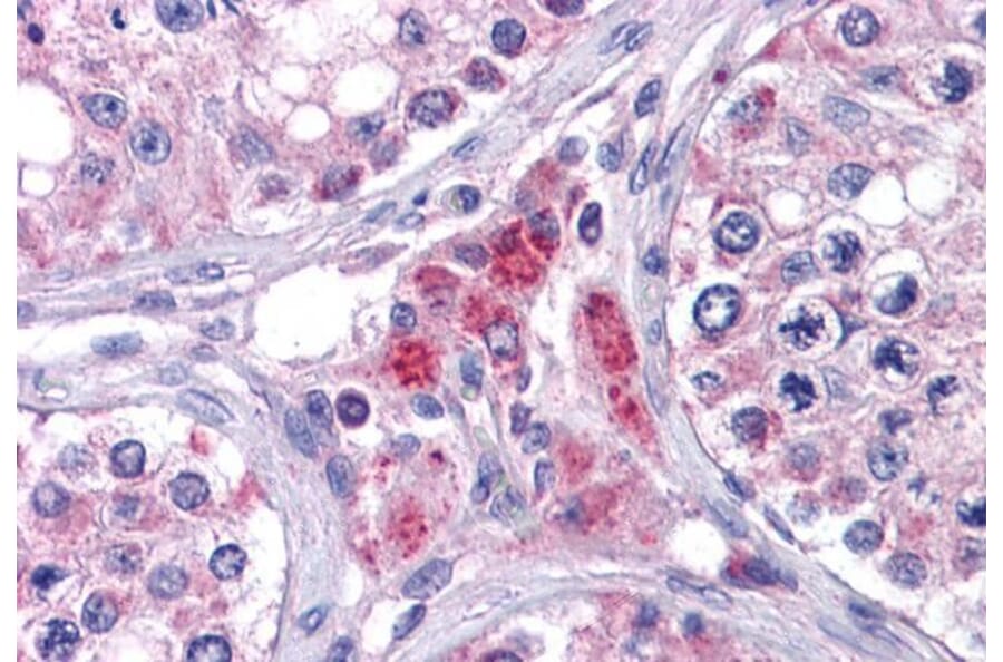 Immunohistochemistry - Anti-EYA4 Antibody (A83181) - Antibodies.com