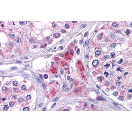 Immunohistochemistry - Anti-EYA4 Antibody (A83181) - Antibodies.com