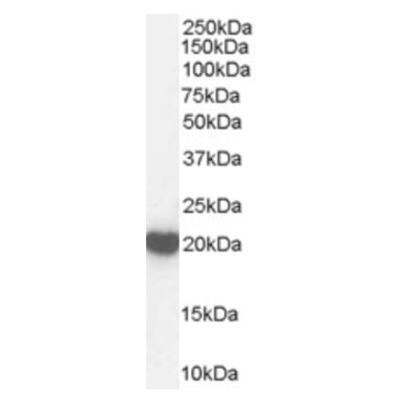 Western Blot - Anti-Peroxiredoxin 2 Antibody (A83182) - Antibodies.com