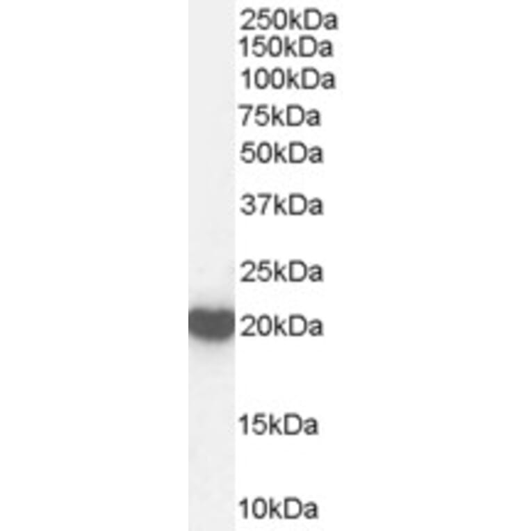 Western Blot - Anti-Peroxiredoxin 2 Antibody (A83182) - Antibodies.com