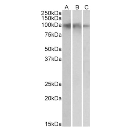 Western Blot - Anti-TrkB Antibody (A83183) - Antibodies.com