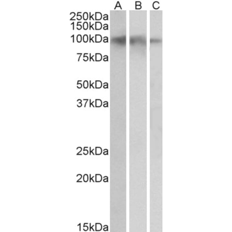 Western Blot - Anti-TrkB Antibody (A83183) - Antibodies.com