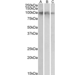 Western Blot - Anti-NTRK2 Antibody (A83183) - Antibodies.com