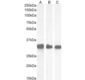 Western Blot - Anti-FHL1 Antibody (A83184) - Antibodies.com