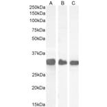 Western Blot - Anti-FHL1 Antibody (A83184) - Antibodies.com