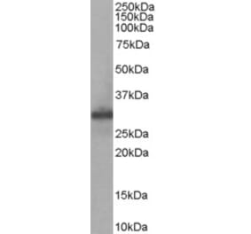 Western Blot - Anti-FHL1 Antibody (A83184)