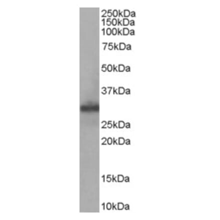 Western Blot - Anti-FHL1 Antibody (A83184)