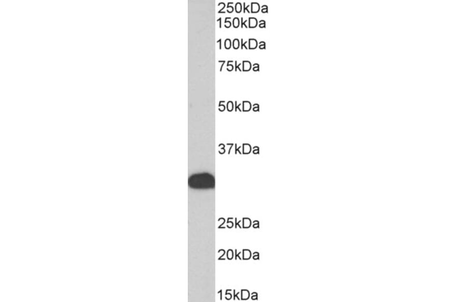 Western Blot - Anti-FHL1 Antibody (A83185) - Antibodies.com