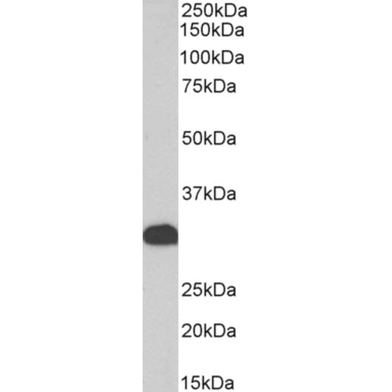 Western Blot - Anti-FHL1 Antibody (A83185) - Antibodies.com