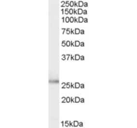 Western Blot - Anti-TPD52L1 Antibody (A83187) - Antibodies.com
