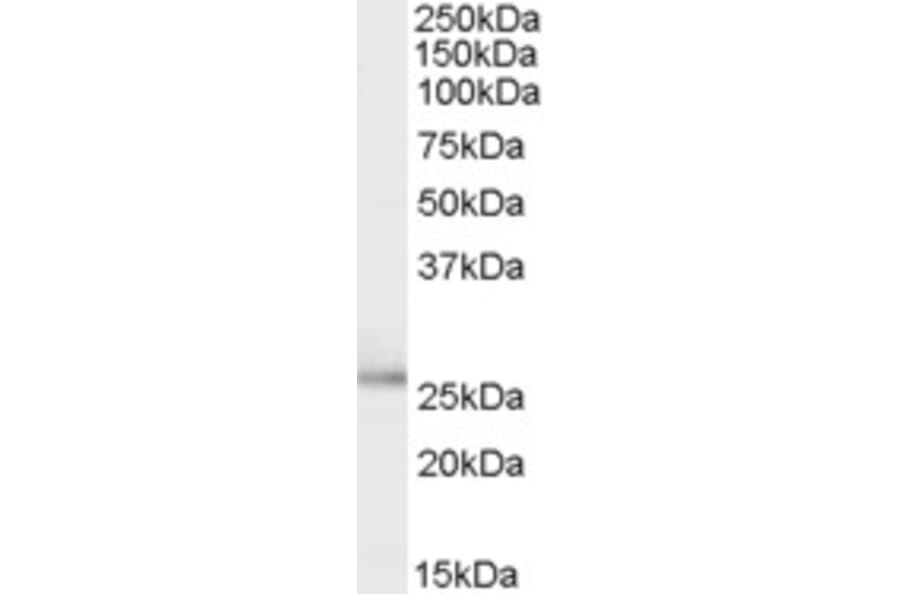 Western Blot - Anti-TPD52L1 Antibody (A83187) - Antibodies.com