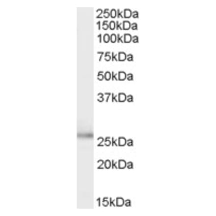 Western Blot - Anti-TPD52L1 Antibody (A83187) - Antibodies.com