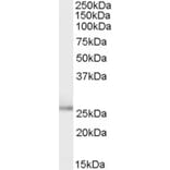 Western Blot - Anti-TPD52L1 Antibody (A83187) - Antibodies.com