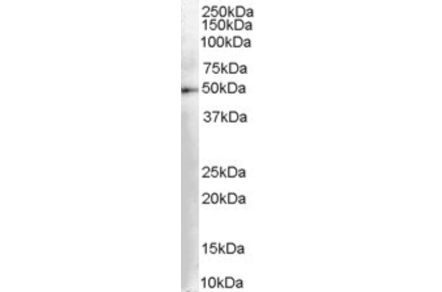 Western Blot - Anti-DOPA Decarboxylase/DDC Antibody (A83188) - Antibodies.com